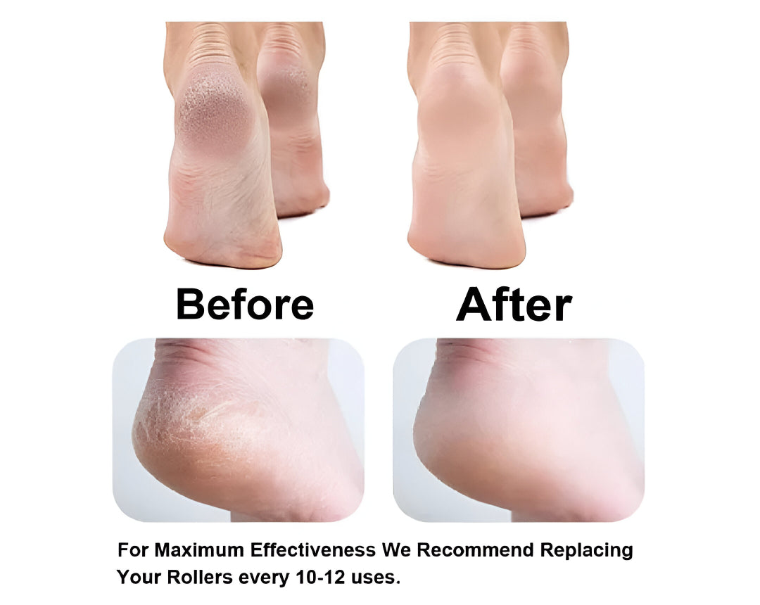Electric Foot Grinder Callus remover Rechargeable Tool for smooth skin